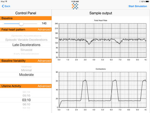 Contraction Monitor Chart