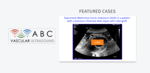 free vascular ultrasound medical simulation scenarios