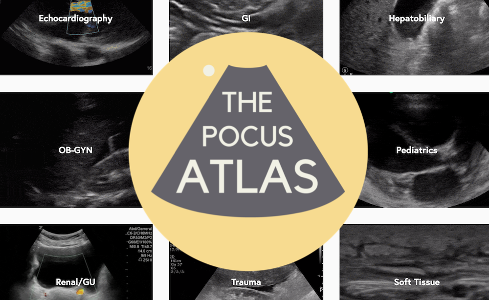 Point of Care Ultrasound Atlas