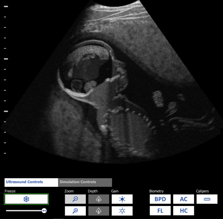 Ultrasound Simulation