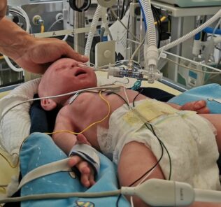 neosim LuSi neonatal lung simulator